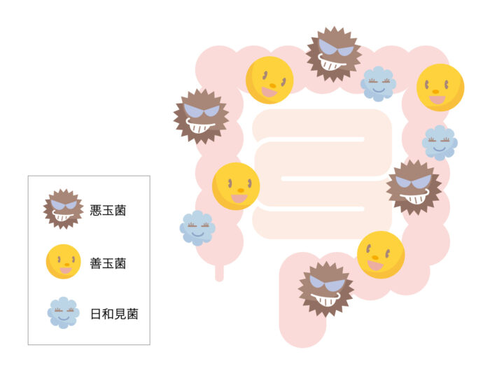 便秘